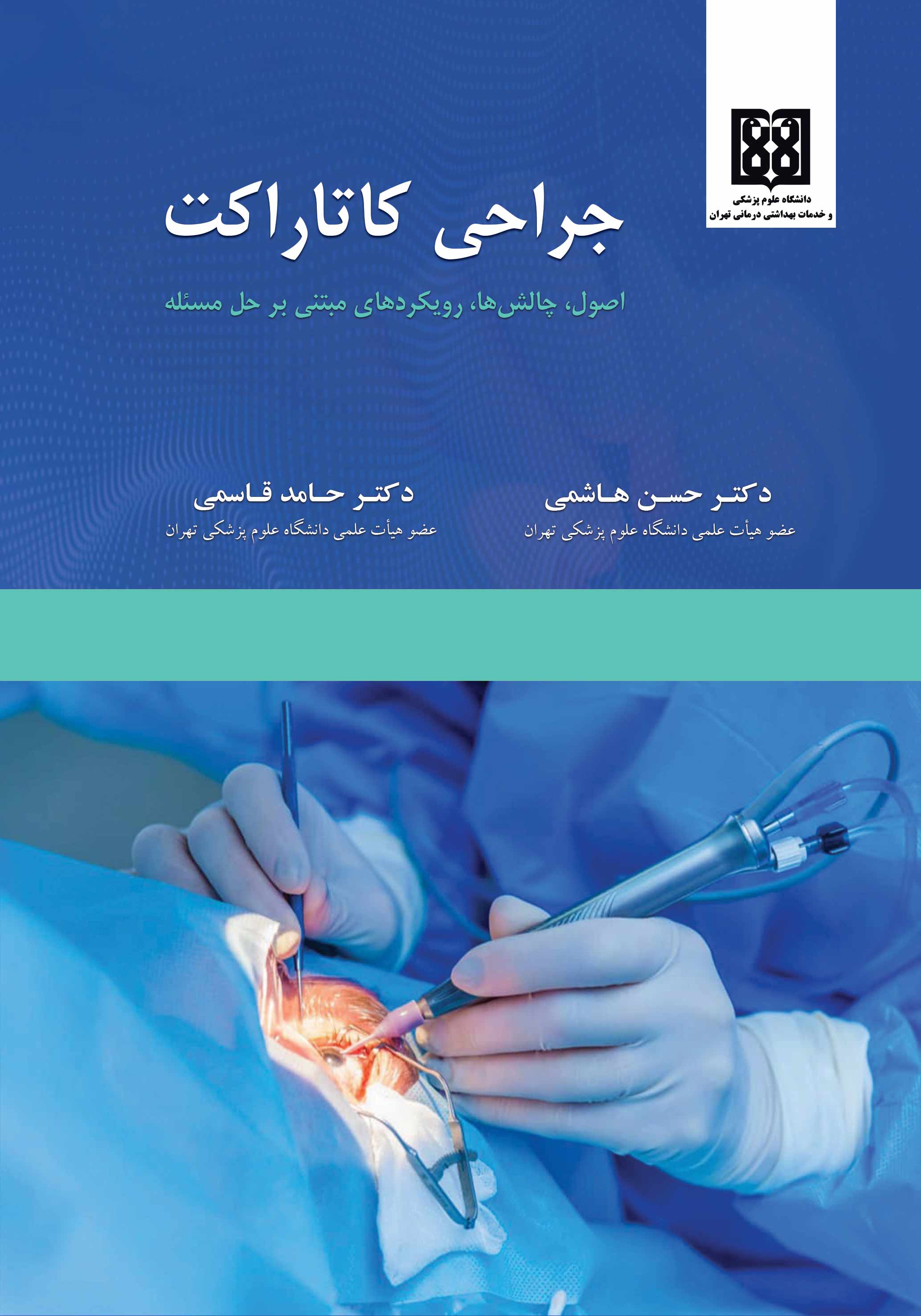 جراحی کاتاراکت 